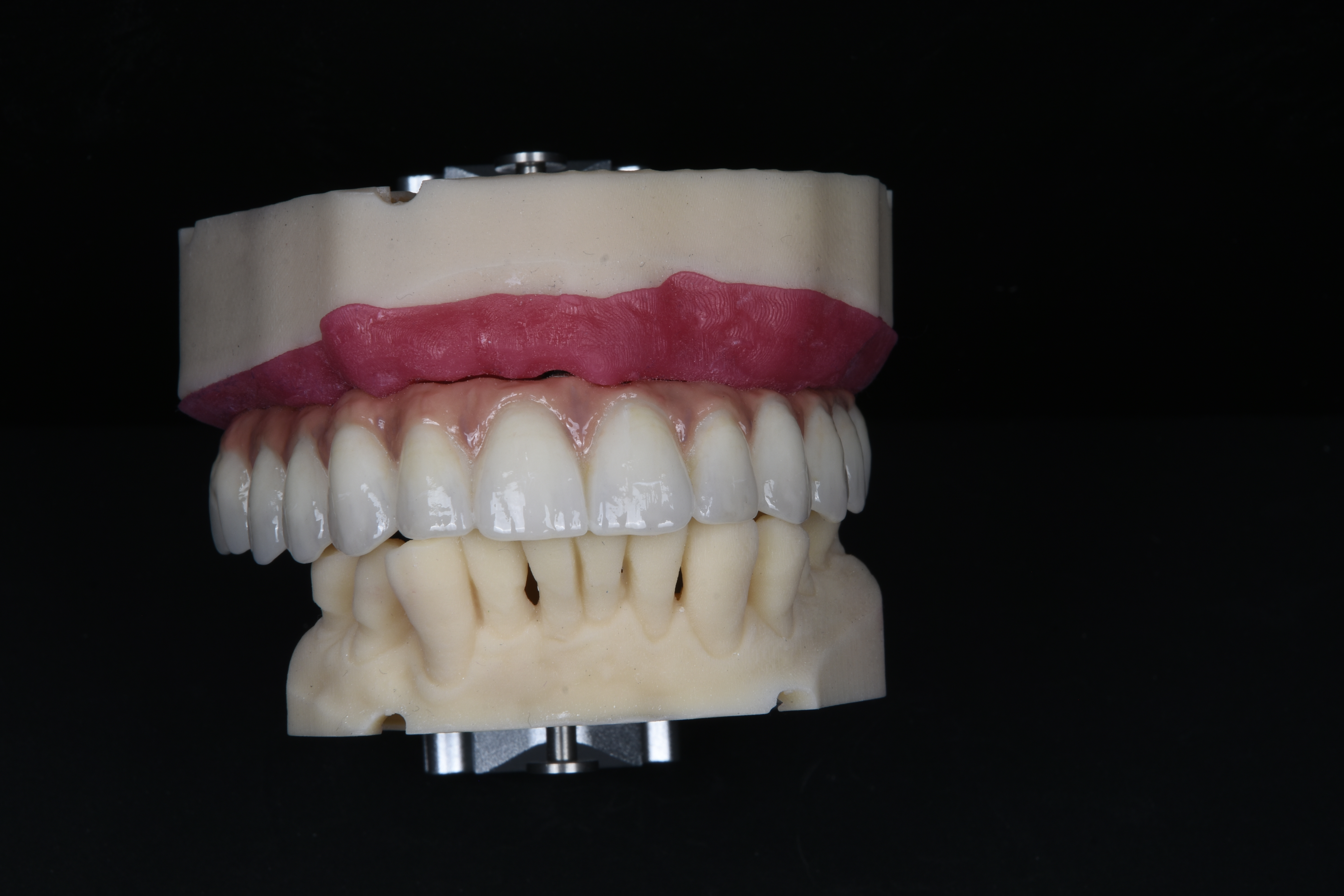 FullArchCase 19