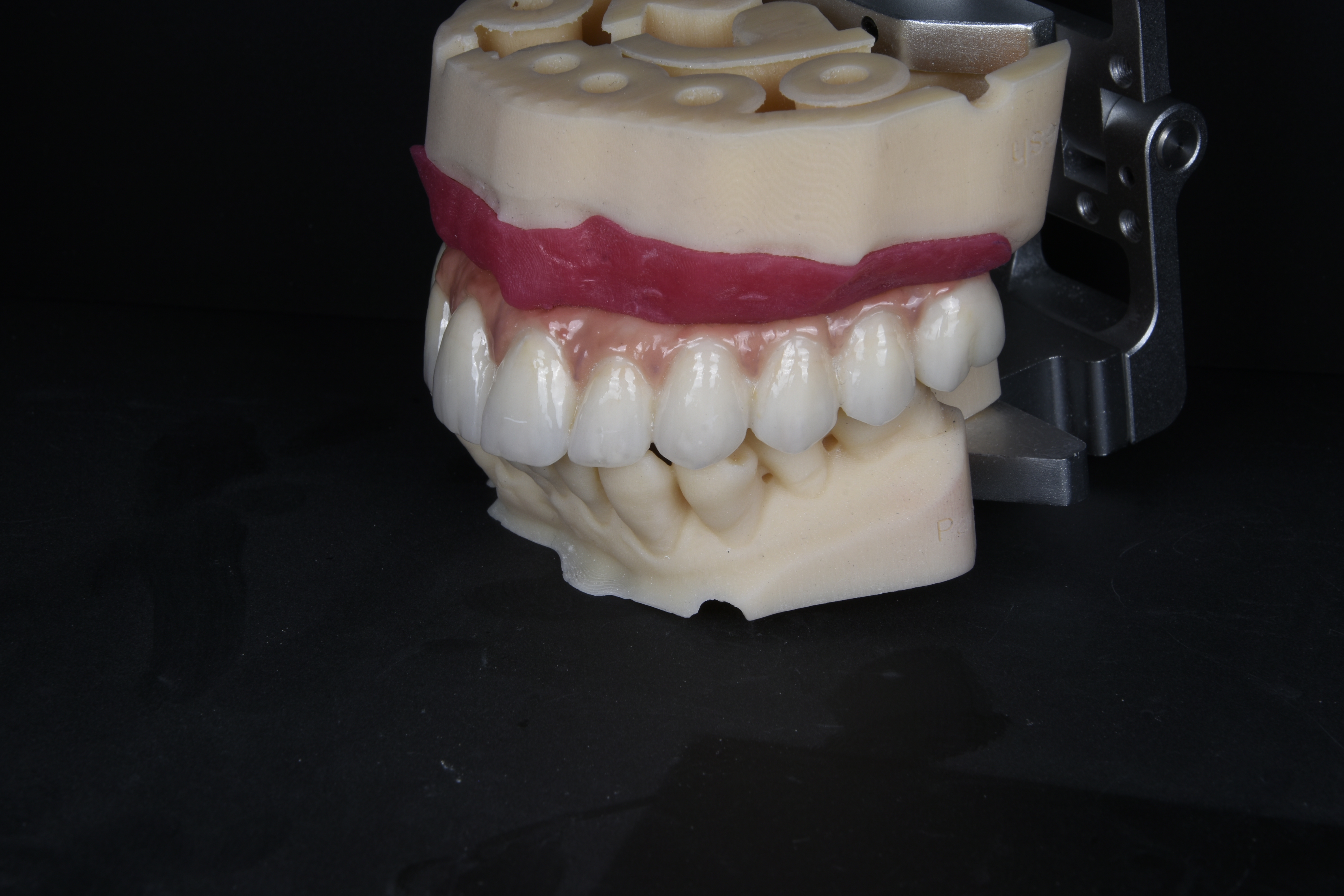 FullArchCase 18